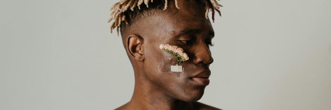 Aloe Vera gegen Pickel und Akne